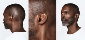 İstanbul Etfal işitme cihazları uygulama Merkezi